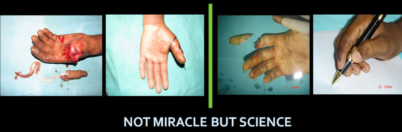 surgery1