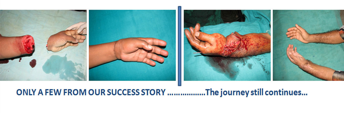 surgery2